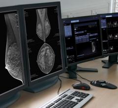 Siemens Healthineers Syngo.Breast Care Adding AI-Based Decision Support
