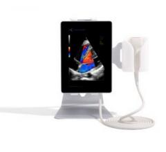 Sonoscanner Obtains FDA Approval for U-lite EXP Portable Ultrasound