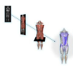 sports medicine, MRI, musculoskeletal