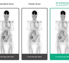 Subtle Medical Showcases Artificial Intelligence for PET, MRI Scans at RSNA 2018