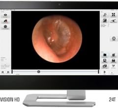 SweetVision HD, endoscope, ThinkTank Technologies