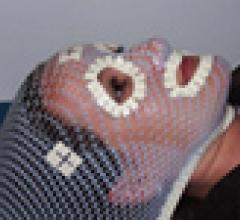 Thermo-Plastic Mask Protects Patients from Rough Edges