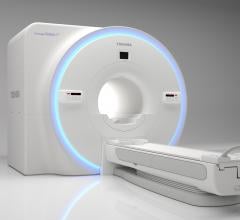 Toshiba Medical Launches Galan RT Solutions for MRI Radiation Therapy Planning