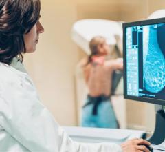 The performance of Transpara is the subject of research being presented this week at RSNA, with two studies demonstrating the potential for Transpara to safely reduce workload in the clinical workflow of a double-reading breast cancer screening program.