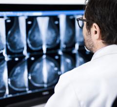 Computers Equal Radiologists in Assessing Breast Density and Associated Breast Cancer Risk