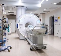 UChicago Medicine Adds Intraoperative MRI Capabilities