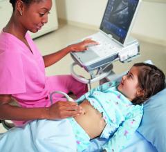 St. Louis Children's Hospital Appendicitis Ultrasound CT Scan Clinical Study