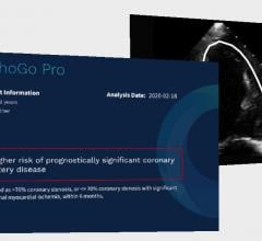 EchoGo Pro automates cardiac ultrasound measurements for heart functions, but also empower physicians to predict the occurrence of coronary artery disease (CAD).
