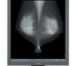 U.S. Electronics Inc. MS35i2 Grayscale Diagnostic Monitor Mammography