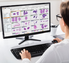 Deciphex, a provider of pathology software and services, has announced the launch of it Digital Research Pathology Platform, Patholytix 3.0. 