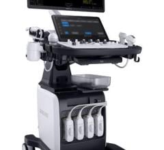 The V7 ultrasound system delivers a multi-faceted diagnostic experience to imaging professionals across hospital departments – aiding clinician performance and patient care