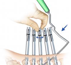 hybrid or ct systems depuy synthes spin brain lab airo mobile viper 2