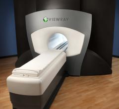 viewray mri systems radiation therapy