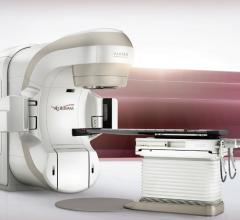 Varian, VitalBeam, IMRT, ESTRO, radiotherapy