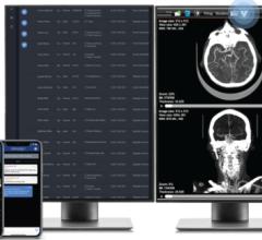 Screen shots of Viz Radiology Suite including worklist and PACS integration (Graphic: Business Wire) 
