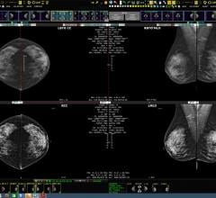 Ikonopedia and Konica Minolta Showcase Integrated Breast Imaging Workflow and Reporting at RSNA