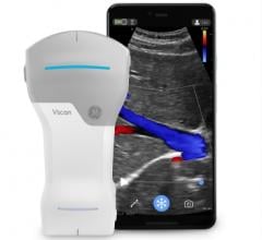 Vscan Air, a pocket-sized ultrasound from GE Healthcare, enters the market as one of the smallest and lightweight handheld devices without compromising crystal clear image quality and secure data sharing. (Photo: Business Wire)