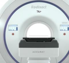 Accuray, Radixact Treatment Delivery Platform, image-guided radiation therapy, AAPM, CE Mark
