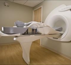 breast MRI, additional multicentric cancers, mammography, Chiara Iacconi, Radiology journal