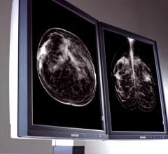 Joint Venture Partnership Opening 16 New Breast Screening Sites in Texas