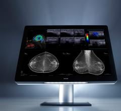 Barco, patent, I-Luminate technology, breast imaging, Just Noticeable Differences, mammography