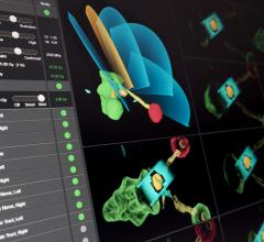 Brainlab, Elements Cranial SRS software, stereotactic radiosurgery, ESTRO 35, radiation therapy