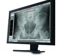 Carestream ImageSuite Software Imaging Orthopedic Imaging