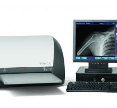 Carestream Genesis Digital Imaging CR Systems DR Systems X-ray Systems