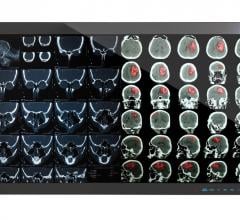 Canvys, 4K2K custom displays, medical monitors, Richardson Healthcare, RSNA 2016