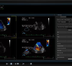 pacs remote viewing systems rsna 2013 cerner skyvue