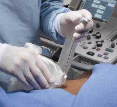 electromagnetic needle tip tracking