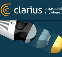 Clarius Introduces Pocket Ultrasound Tri-Scanner