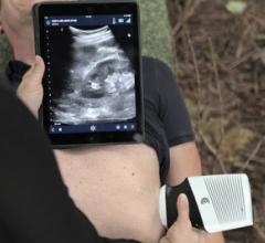 Clarius Demonstrates Point-of-Care Ultrasound for Disaster and Emergency Medicine