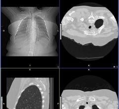 pacs rsna 2013 exam-pacs 3.0 coactiv