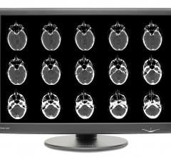 New Dome GX Series Widescreen Radiology Display Now Shipping from NDS Surgical Imaging