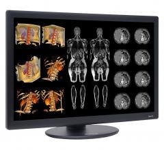NDS Surgical Imaging Dome S6c Diagnostic Flat Panel Display RSNA 2014