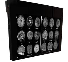 Flat Panel Displays, RSNA 2014, MRI Systems, DBI24-MRSafe
