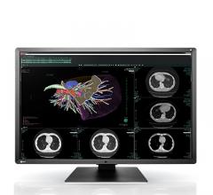 Eizo, RadiForce RX660 medical monitor, RSNA 2016, 6-megapixel