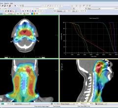 Elekta, Monaco radiotherapy treatment planning system, radiation therapy, AAPM studies