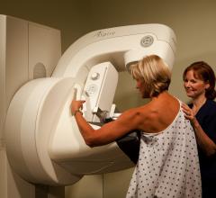 Aspire Mammography