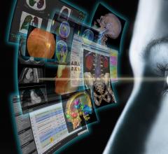 RSNA 2013 pacs fujifilm synapse portfolio workstation software dicom ris