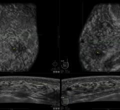 KLAS, women's imaging, 3-D tomosynthesis, breast imaging