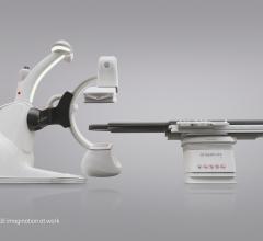 GE Introduces Discovery IGS 740 Mobile Angiography System