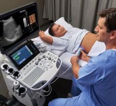 GE Healthcare and Echosens Introduce Integrated Liver Package for Logiq S8 XDclear 2.0 Ultrasound