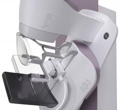 GE Healthcare, Senographe Pristina mammography system, launch, RSNA 2017, patient comfort