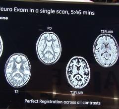 Magic, sigma Pioneer, GE, multiple contrasts in one MRI scan