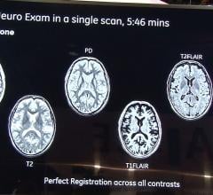Quality of MAGiC Brain Scans Non-Inferior to Conventional MRI