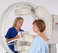 Gamma Medica, Alpha Imaging, LumaGEM molecular breast imaging system, MBI, distribution agreement