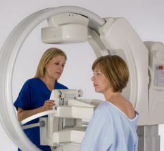 Gamma Medica, LumaGEM molecular breast imaging system, MBI technology, Major Health Partners Indiana