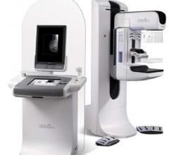 Hologic, Genius 3-D Mammography, KLAS Research, U.S. breast tomosynthesis market, C-View